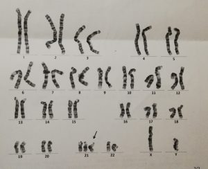 染色体検査結果