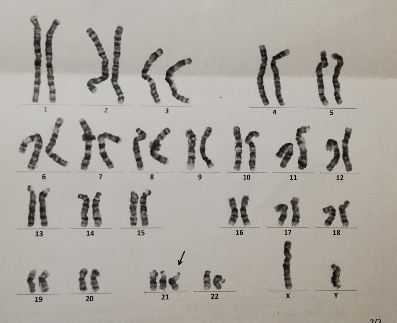 染色体検査結果